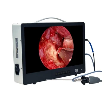 Fabrika fiyat 4 in 1 Full HD tıbbi endoskop kamera sistemi ile 24 inç monitör 100 W led ışık kaynağı ve HD kaydedici